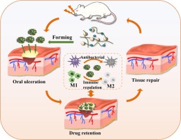 A polyglutamic acid/tannic acid-based nano drug delivery system: Antibacterial, immunoregulation and sustained therapeutic strategies for oral ulcers