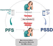 POST-FINASTERIDE SYNDROME AND POST-SSRI SEXUAL DYSFUNCTION: TWO CLINICAL CONDITIONS APPARENTLY DISTANT, BUT VERY CLOSE
