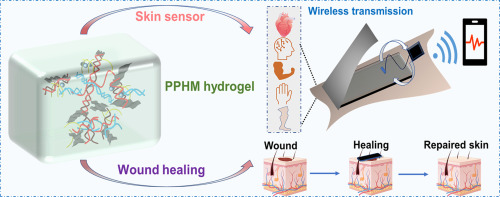 A multifunctional sensor for real-time monitoring and pro-healing of frostbite wounds