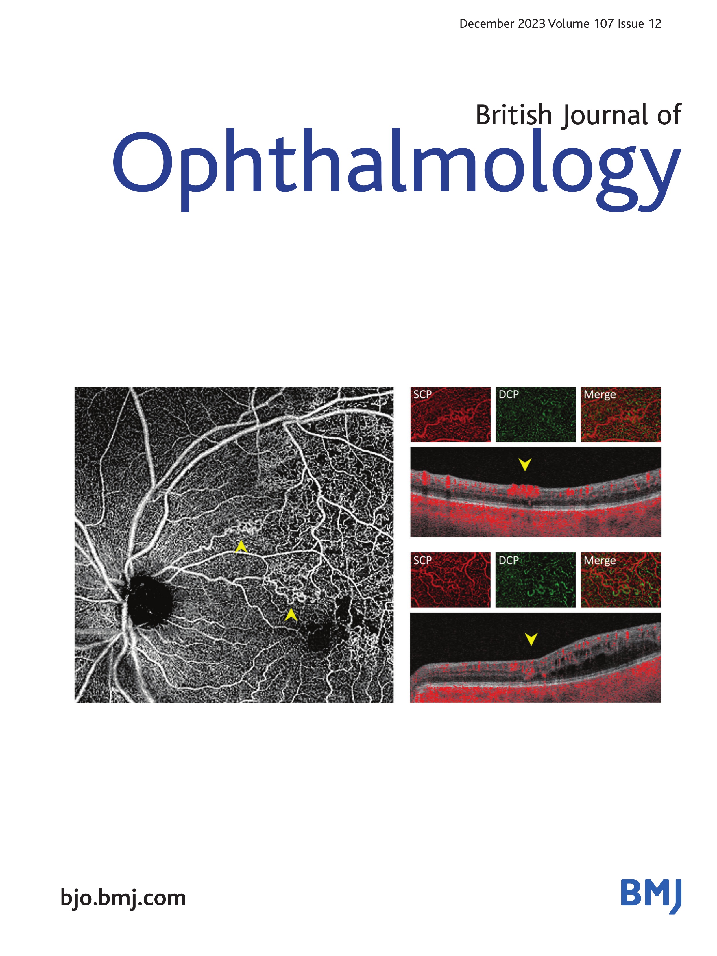 Macular thickness and its associated factors in a Chinese rural adult population: the Handan Eye Study