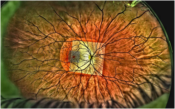Multi-modal retinal imaging for investigating neurovascular health