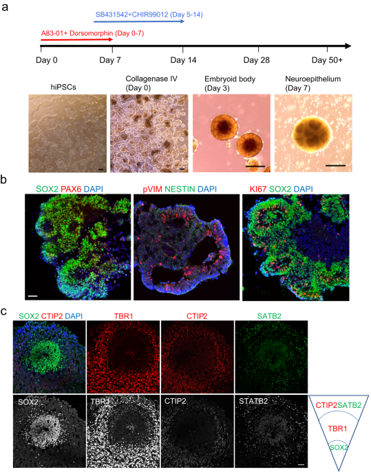 Germline PTEN genotype-dependent phenotypic divergence during the early neural developmental process of forebrain organoids