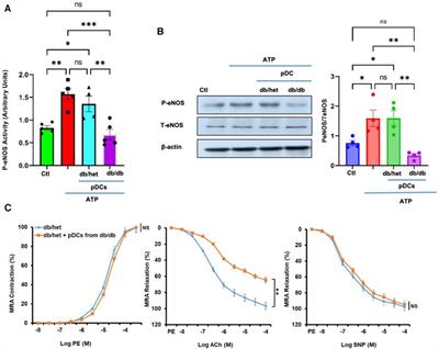 Plasmacytoid dendritic cells contribute to vascular endothelial dysfunction in type 2 diabetes