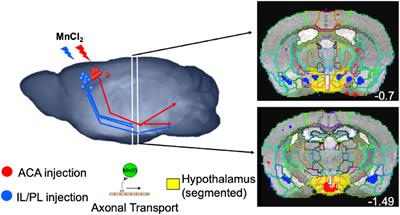 Harnessing axonal transport to map reward circuitry: Differing brain-wide projections from medial prefrontal cortical domains