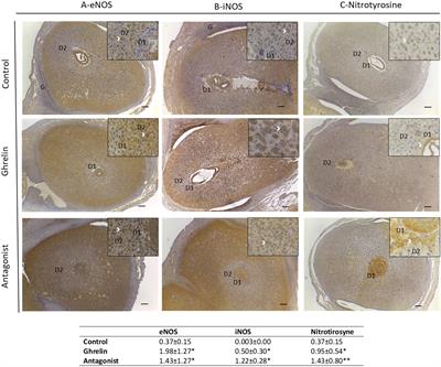 Ghrelin misbalance affects mice embryo implantation and pregnancy success by uterine immune dysregulation and nitrosative stress